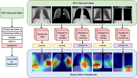 validity of chest x ray result|Validating deep learning inference during chest X.
